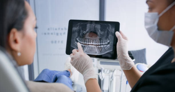 Licensed Tooth Extraction service in Huntington, TX - Smile Center Dentistry